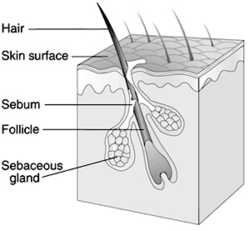 Sebaceous gland and hair follicle diagram